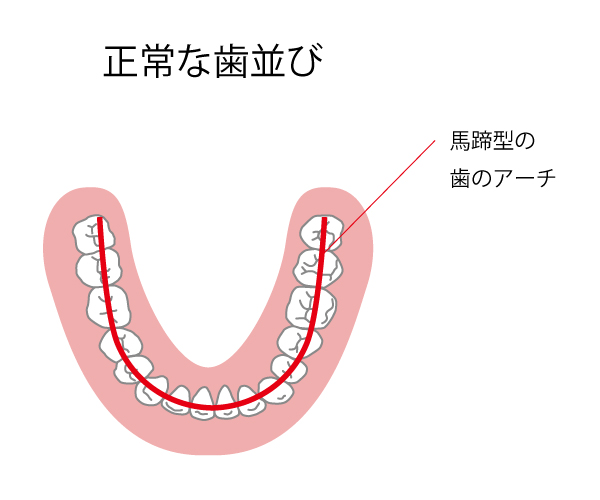 正常な歯並びイメージ