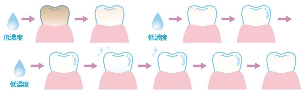 ホームホワイトニングのシェード遷移イメージ